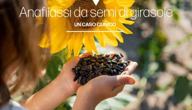 Anafilassi indotta da semi di girasole in un bambino: un caso clinico