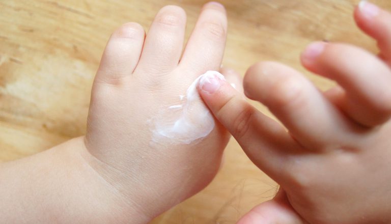 Bambini e dermatite atopica, guida allo Skin Care