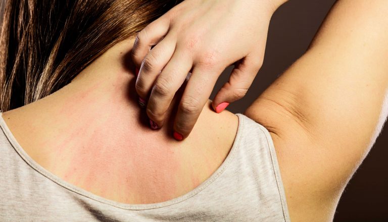 Infezioni cutanee: dalla diagnosi ai nuovi approcci nel trattamento topico