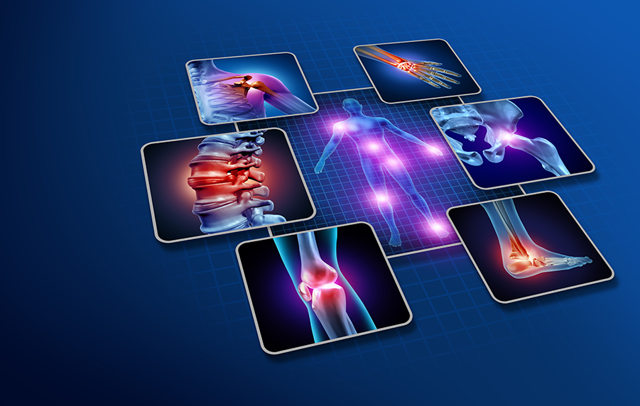 Ipovitaminosi-D-e-osteosarcopenia