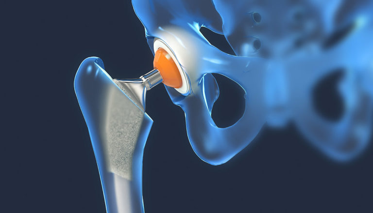 Ortopedia e reumatologia