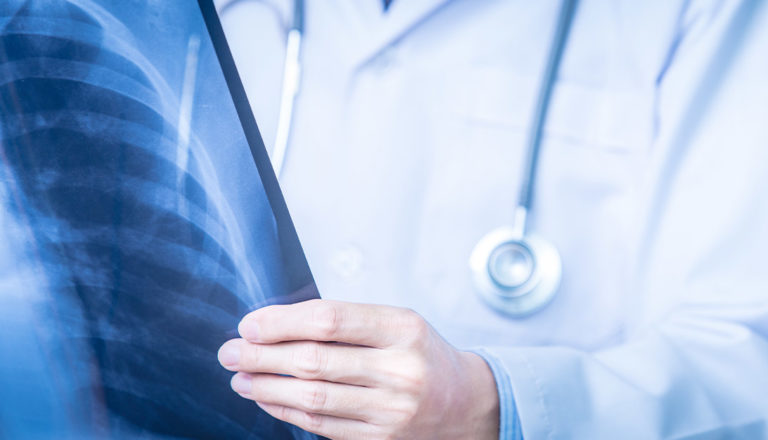 Pneumologia e Malattie Respiratorie